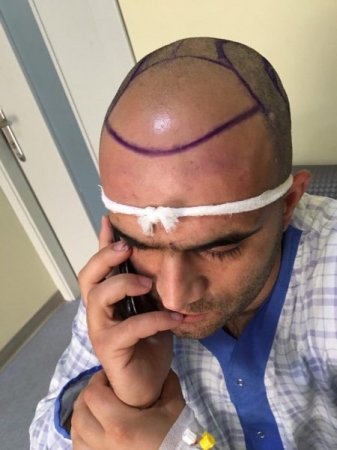 “MediStyle Hospital”da bu dəfə həmkarlarına kəf gəldilər... “MediStyle Hospital”da bu dəfə həmkarlarına kəf gəldilər...