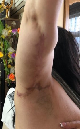 “Avrasiya” klinikasında gənc xanımı şikəst etdilər: “Avrasiya” klinikasında gənc xanımı şikəst etdilər: