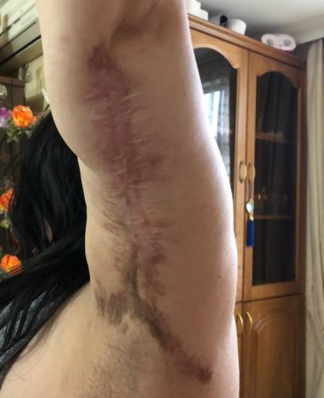 “Avrasiya” klinikasında gənc xanımı şikəst etdilər: “Avrasiya” klinikasında gənc xanımı şikəst etdilər: