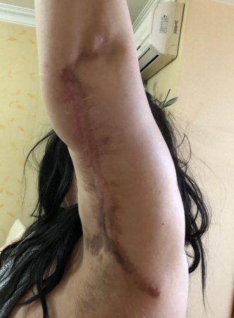 “Avrasiya” klinikasında gənc xanımı şikəst etdilər: “Avrasiya” klinikasında gənc xanımı şikəst etdilər: